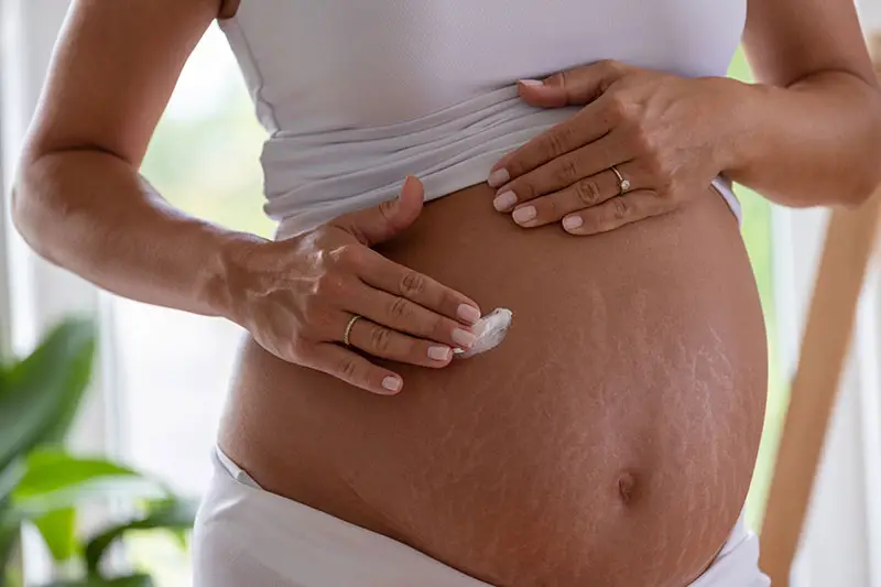 A pregnant woman using cream to keep her skin hydrated. This can help prevent dry skin once the skin responds to the moisture.